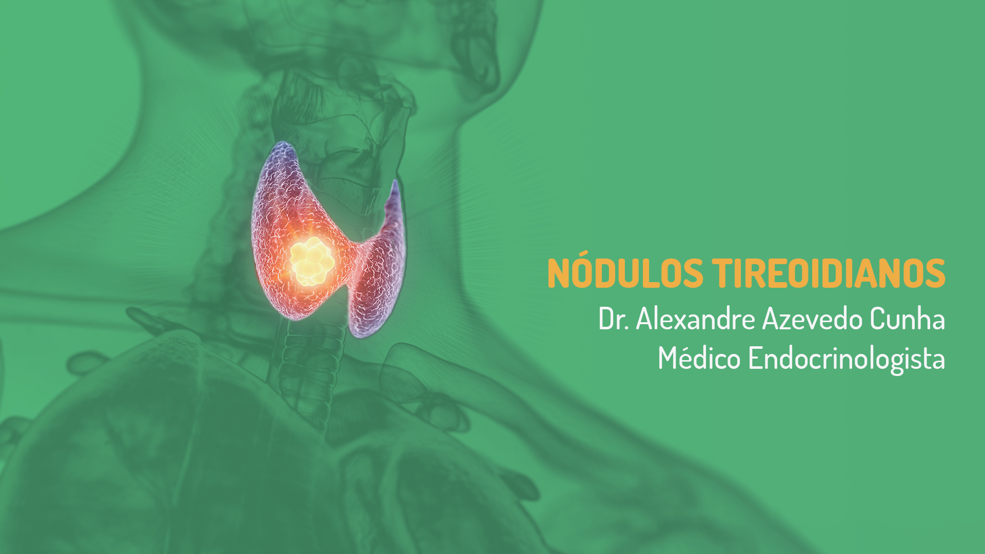 NÃ³dulos Tireoidianos â Devo me preocupar?